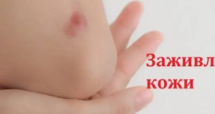 заживление кожи