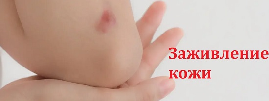 заживление кожи
